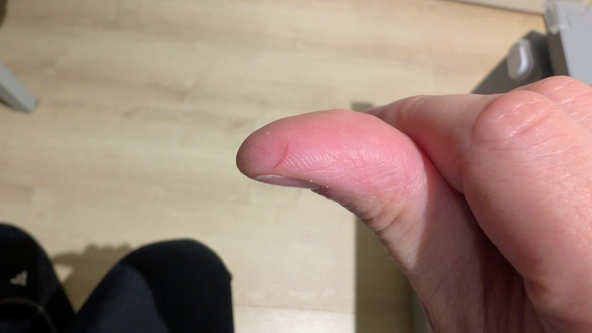 Fingertip with fresh cut from laser sled maintenance during Wondermega Victor RG-M1 restoration work.